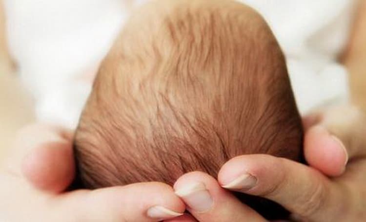 Главное о родничках у новорождённого и ответы неонатолога на часто задаваемые вопросы родителей