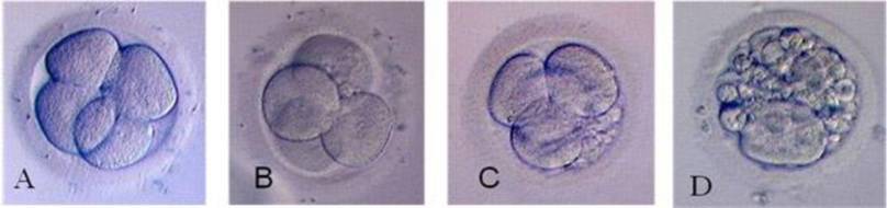Перенос эмбрионов при эко