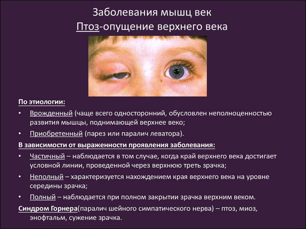 Заболевания глаз. виды и способы лечения