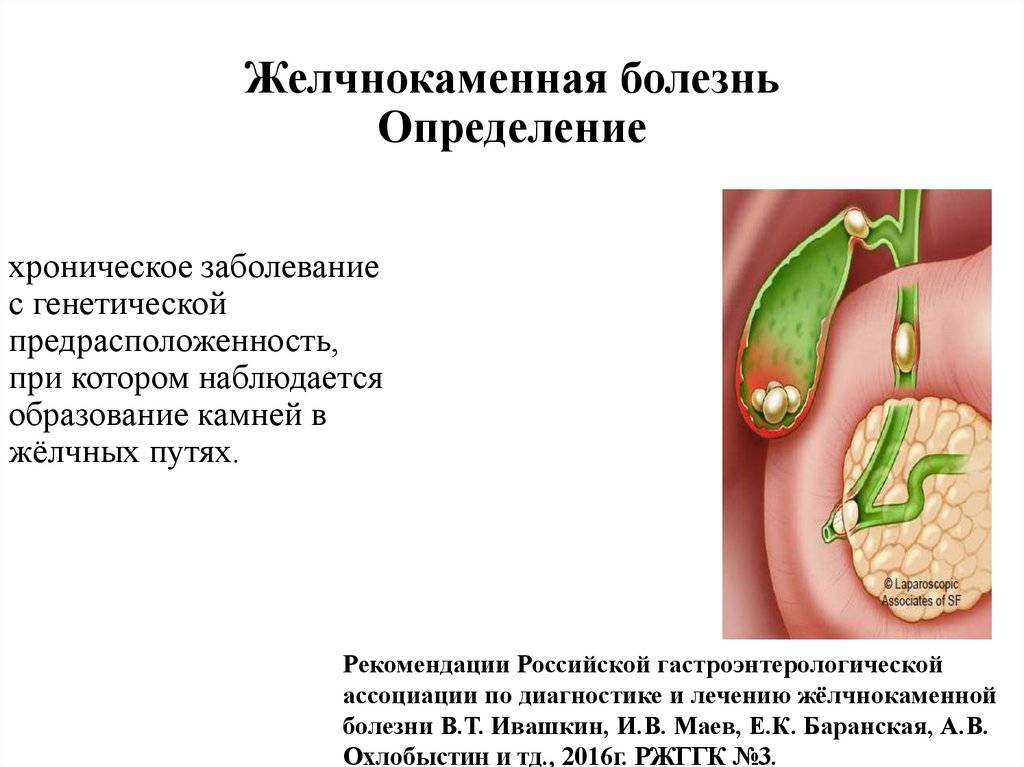 Заболевания желчного пузыря: симптомы, причины, лечение - клиника лоритом
