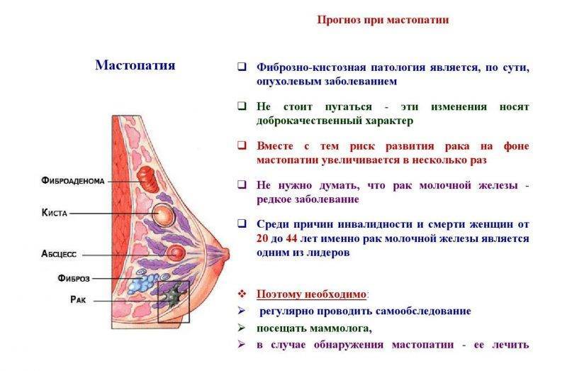 Фиброзная мастопатия | москва