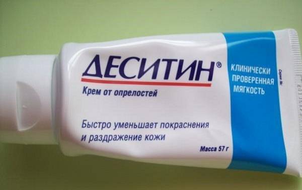 Кандидоз - симптомы, причины развития, лечение