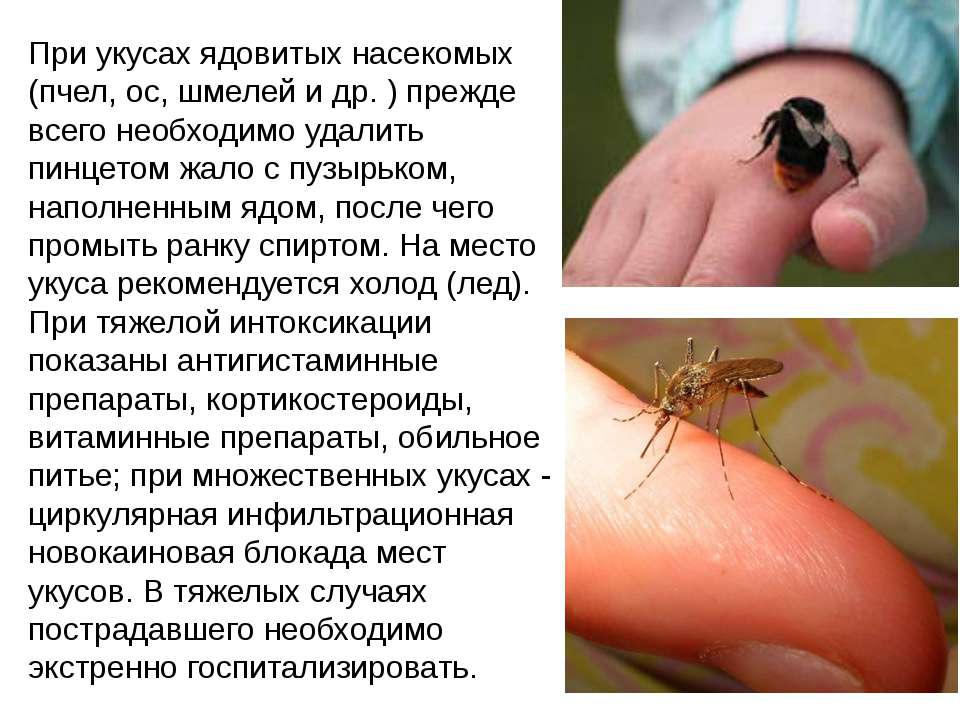 Укусы насекомых у детей
