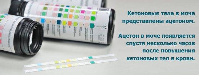 Диагностика протеинурии (памятка для врача)
