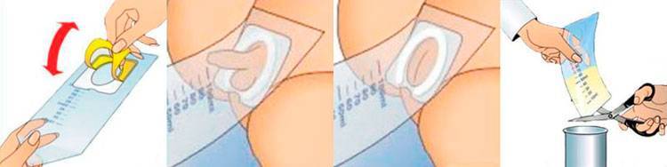 Анализ мочи у грудничка: как взять анализ мочи у мальчика и девочки, как подмывать грудничка перед анализом мочи и другие правила сбора мочи грудничка | qulady