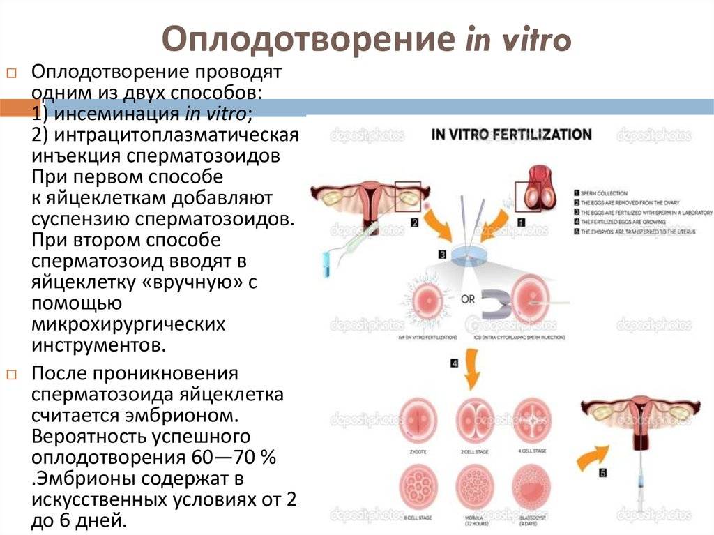 Как происходит криоконсервация ооцитов: все о методе и подготовке