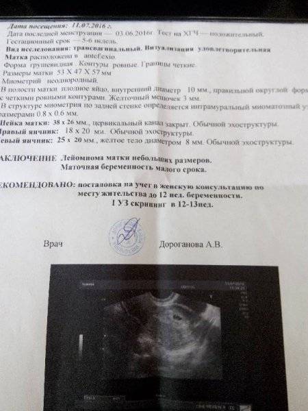 ᐉ желточный мешок неправильной формы. желточный мешок при беременности - ➡ sp-kupavna.ru