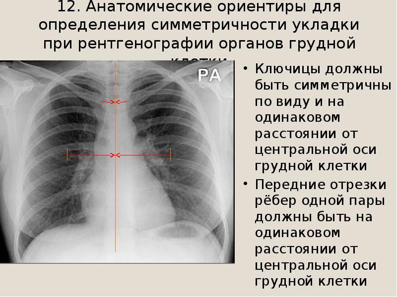 Можно ли кормить грудью после компьютерной томографии