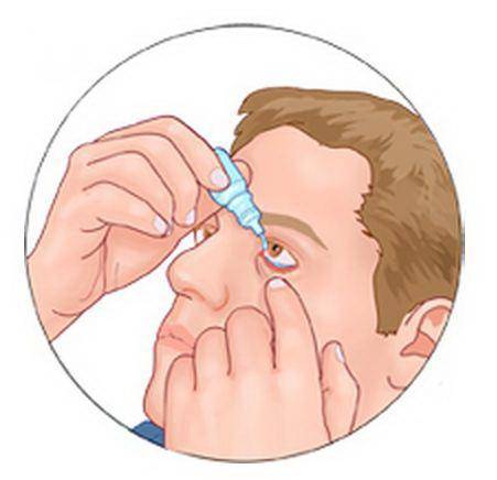 Как правильно закапывать капли в глаза? пошаговая инструкция