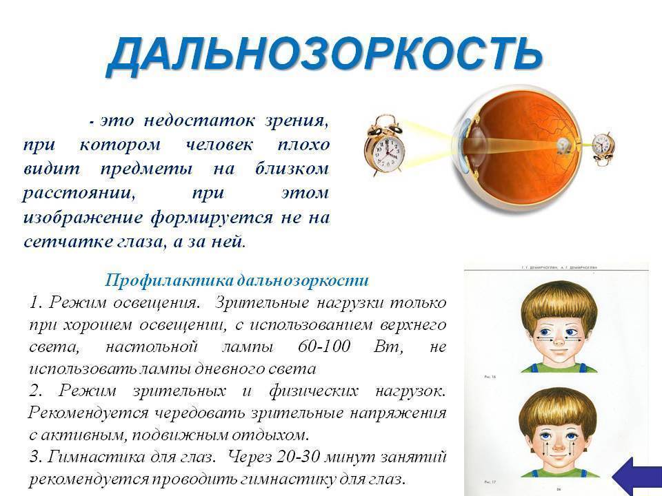 Гиперметропический астигматизм у детей, лечение гиперметропического астигматизма в москве