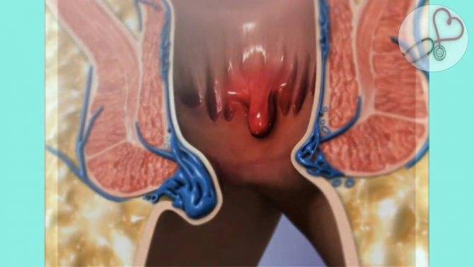 Почему менструация сопровождается нарушением работы желудка и кишечника