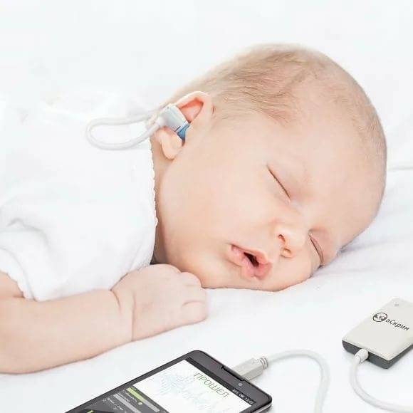 Аудиологический скрининг новорожденных - спб нии лор