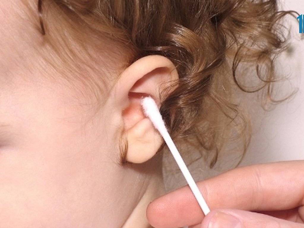 Как почистить уши ребенку от серы 3 года