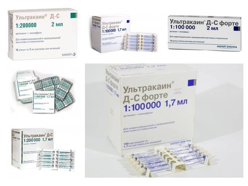 Ультракаин д-с раствор для инъекций 1,7 мл картридж 100 шт.   (sanofi aventis [санофи-авентис]) - купить в аптеке по цене 5 912 руб., инструкция по применению, описание, аналоги