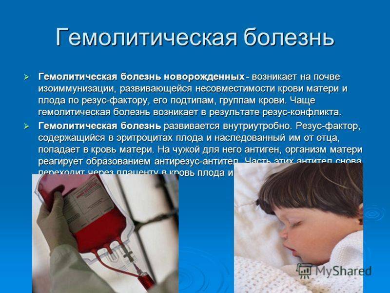 Гемолитическая болезнь новорожденных по группе крови: последствия, лечение и профилактика