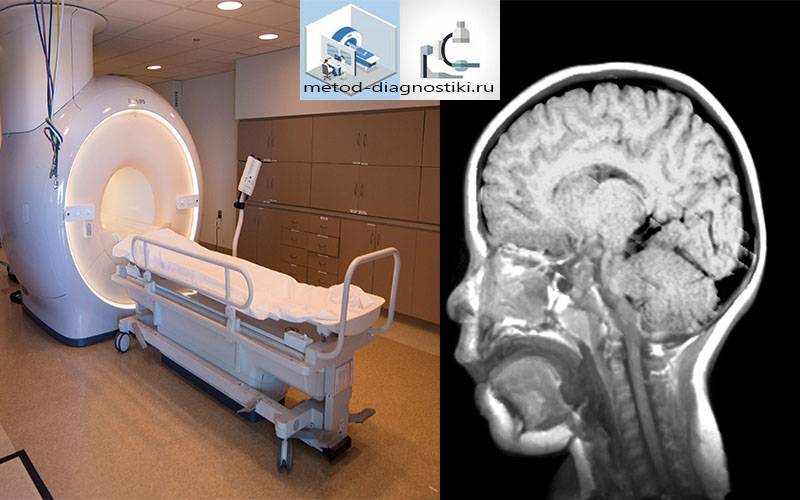 Мрт головного мозга как проходит процедура по времени у взрослого фото