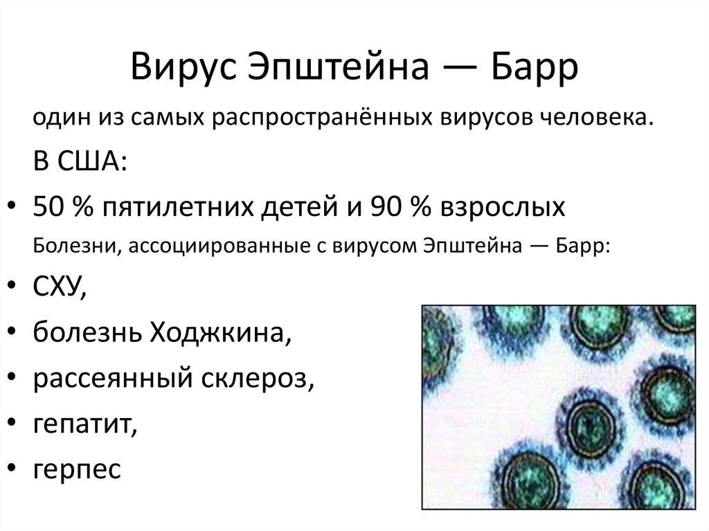 Лечение вируса эпштейна-барр - медицинский портал eurolab