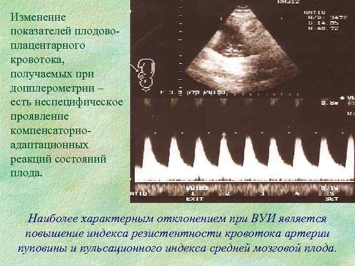 Допплерометрия при беременности в медицинском центре интермед