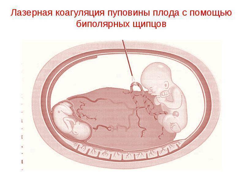 Выделения при прикреплении эмбриона к матке фото