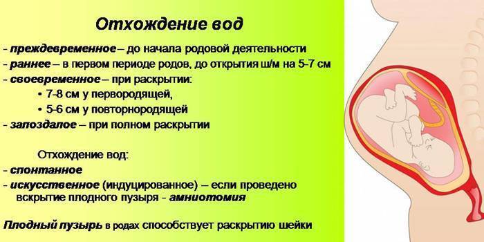 Как выглядит пробка при беременности когда выходит перед родами у повторнородящих фото