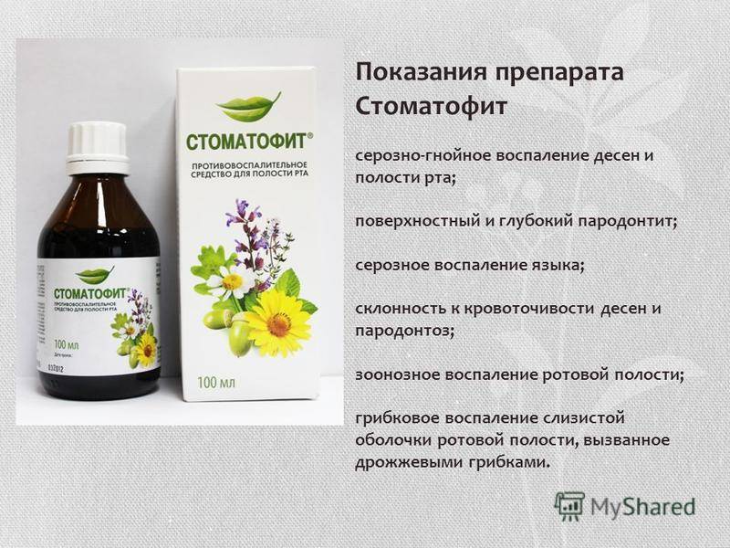 Стоматит