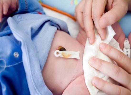 Обработка пупочной ранки у новорожденного: препараты, алгоритм