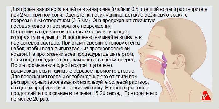 Сопли и кашель у ребенка: влажный кашель с мокротой