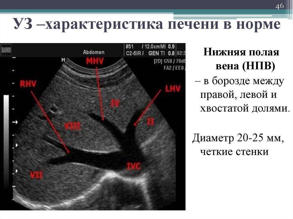 Узи печени картинки норма