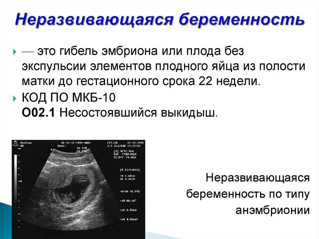 Беременна или нет? узи покажет 5 причин отсутствия эмбриона