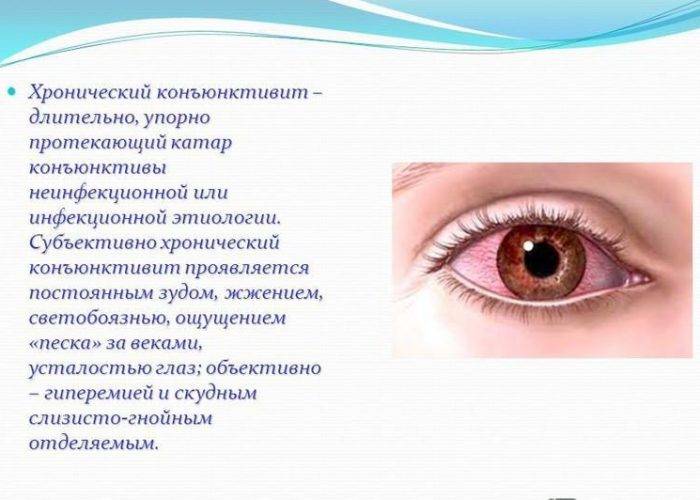 Инфекции глаз: какие бывают и как лечить?