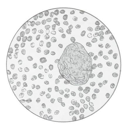 Лецитиновые зерна в спермограмме: особенности, липоидные тельца