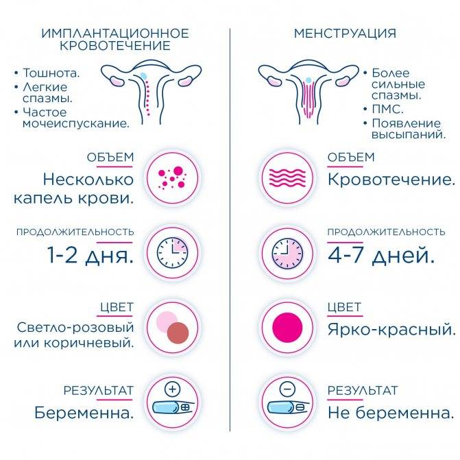 Боли в пояснице перед менструацией | москва