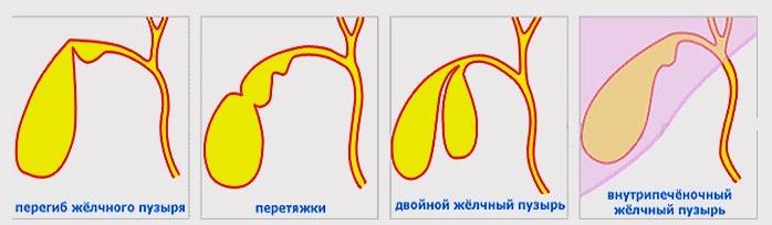 Джвп у детей