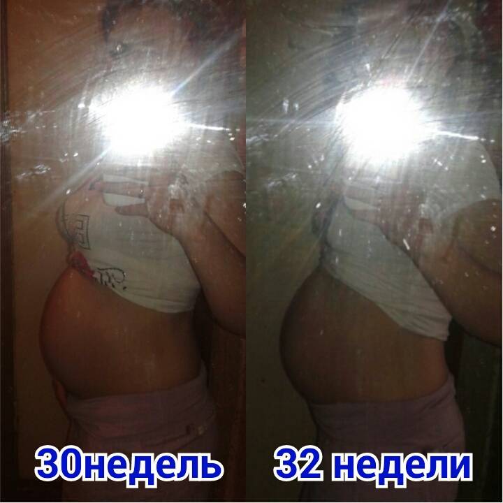 Молозиво при беременности: как выглядит, на каком сроке появляется | parnas42.ru