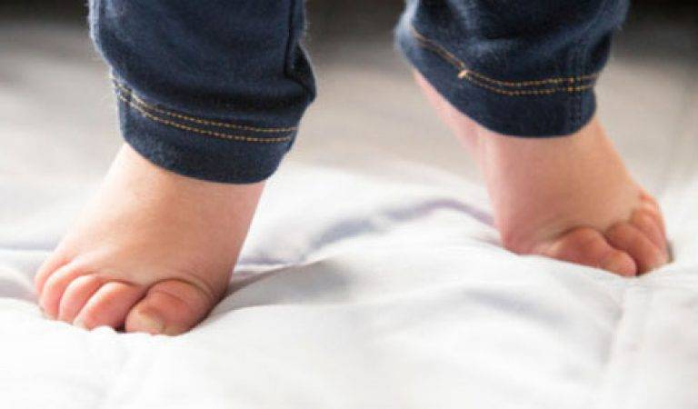 Е. комаровский: ребенок ходит на носочках - причины, почему дети встают на цыпочки