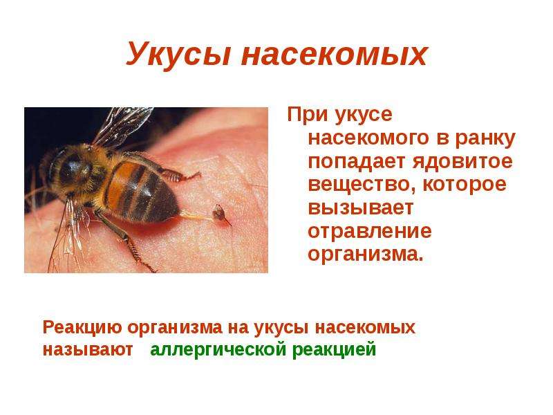 Первая помощь детям при укусах насекомых
