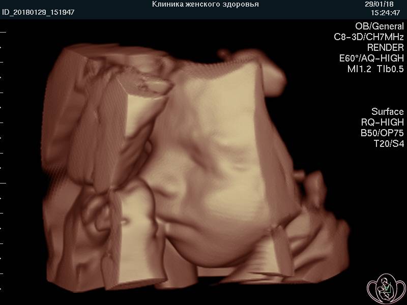 39 неделя беременности – что происходит с ребенком, тошнота на тридцать девятой неделе беременности - agulife.ru