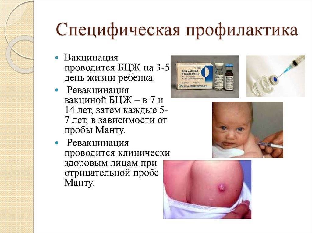 Законодательные требования к проведению профилактических прививок (вакцинации)