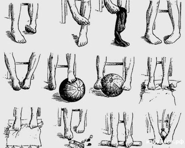 Ортопедические стельки при вальгусной деформации стопы