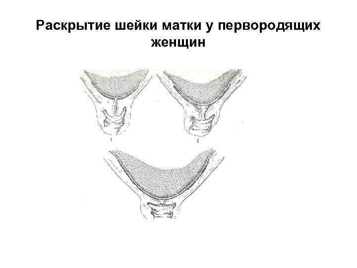 Шейка матки перед родами фото