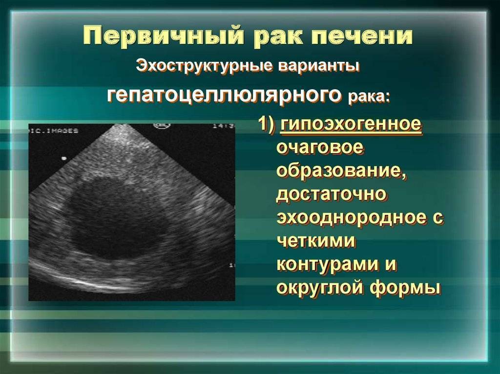 Почему у ребенка может быть увеличена печень и как нормализовать размер