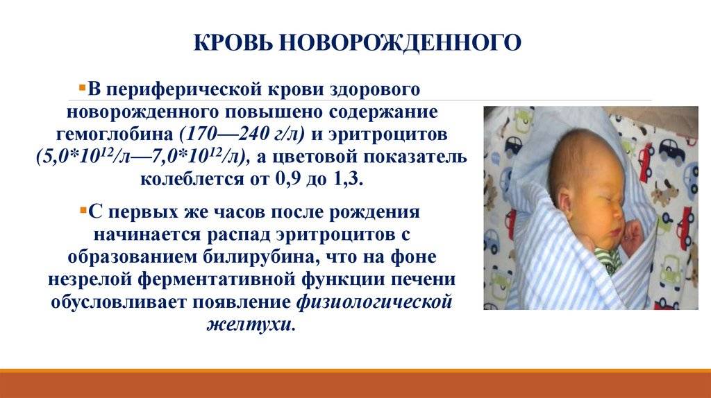 Галактоземия