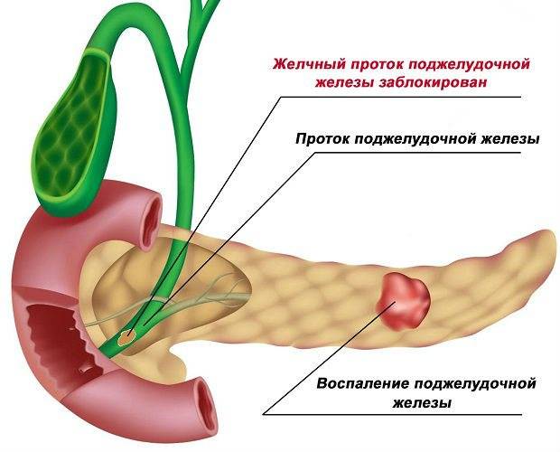 Структурные изменения поджелудочной. Изменения поджелудочной железы при панкреатите. Паренхима-УЗИ поджелудочной железы. Пузырный проток поджелудочной железы. Панкреатический проток поджелудочной железы норма.