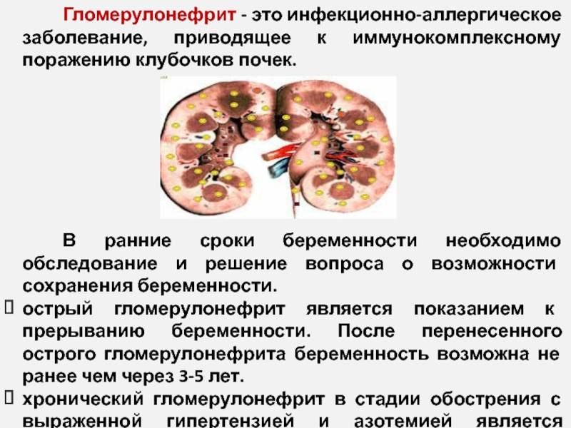 Гломерулонефриты у детей презентация