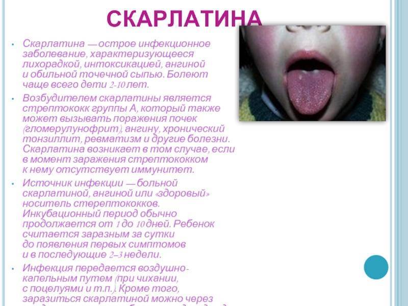Красные точки на небе у ребенка и взрослого: почему возникают и как лечить?