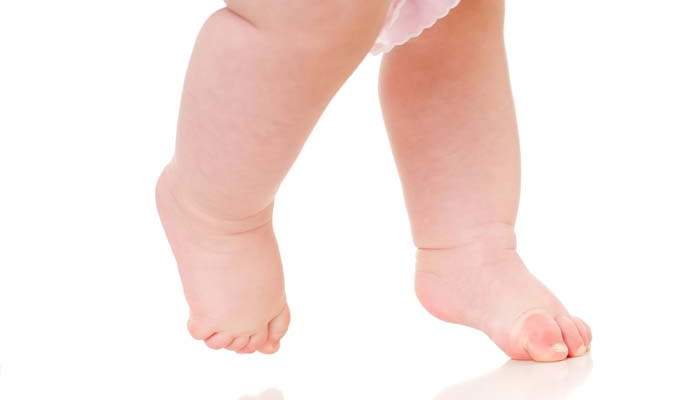 Ребенок ходит на носочках – стоит ли переживать?