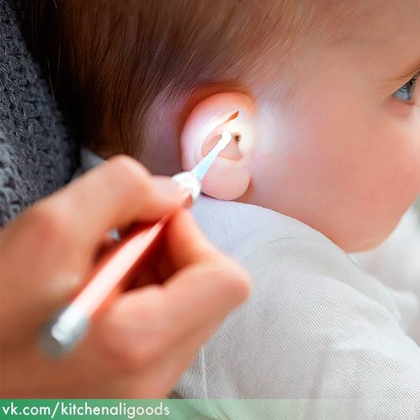 Как часто нужно чистить уши, и что будет, если этого не делать?