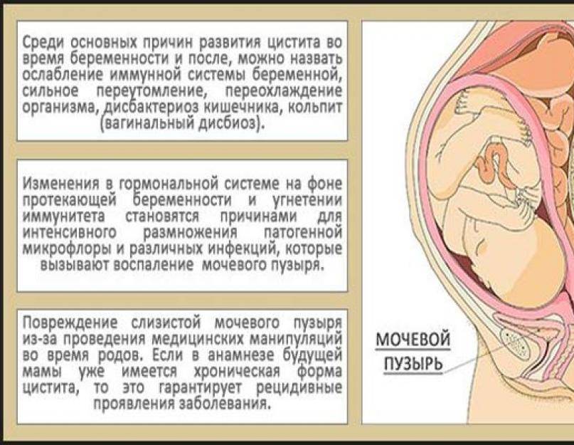 При беременности во втором триместре болит живот: что это означает и что делать?