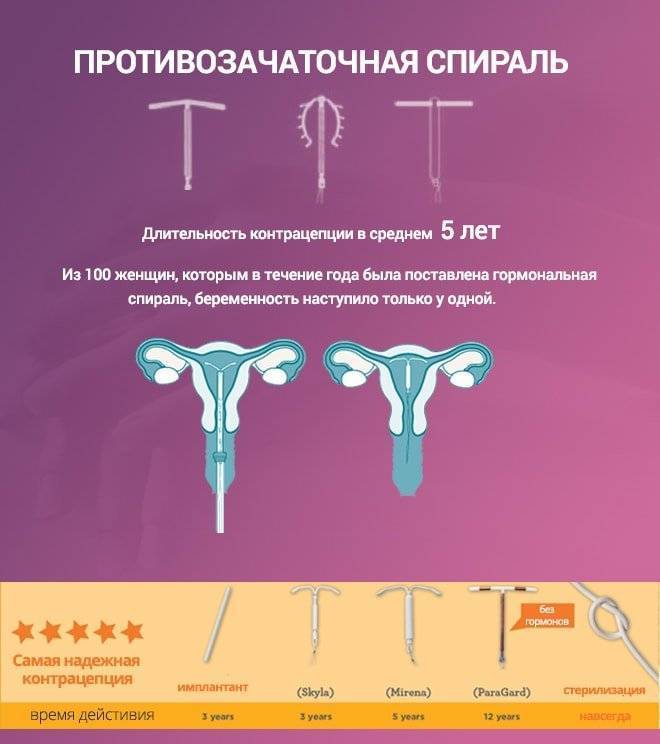 Спираль после кесарева: когда можно поставить, плюсы и минусы контрацепции, как устанавливается внутриматочная спираль от беременности