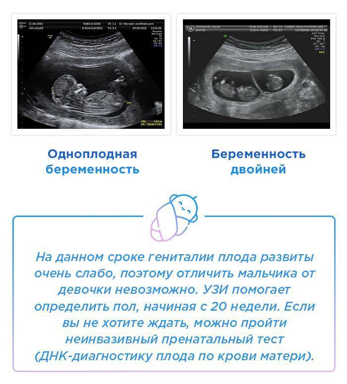 На каком сроке беременности видно двойню на узи?